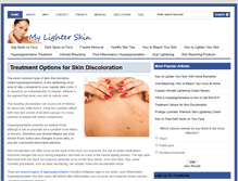 Tablet Screenshot of mylighterskin.com
